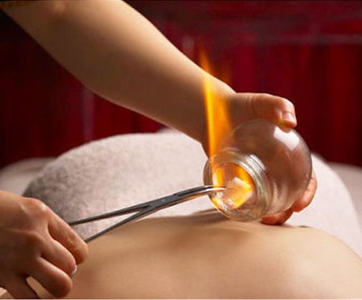 We also offer Cupping
